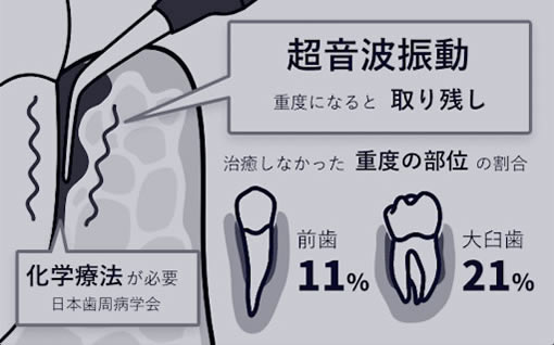 ̕\ʂ̃N[jO