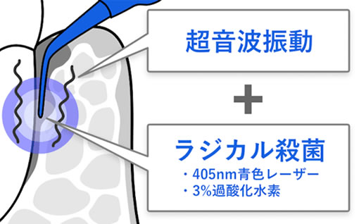 ̌Ԃ̃N[jO