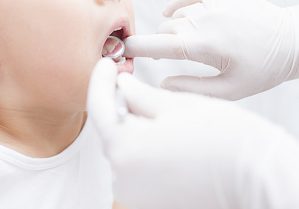 画像：小児歯科