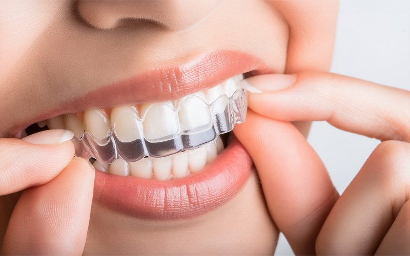 画像：矯正歯科