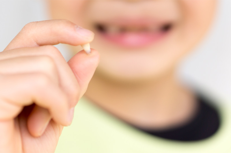 画像：むし歯や早期の乳歯喪失