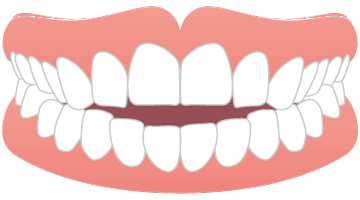 画像：姿勢の悪さ