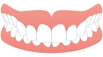 画像：むし歯や早期の乳歯喪失