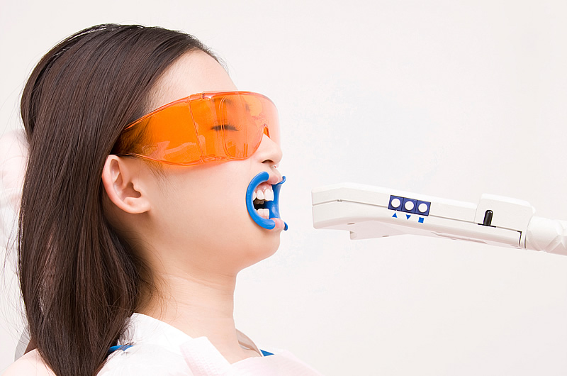 画像：プチホワイトニングの流れ